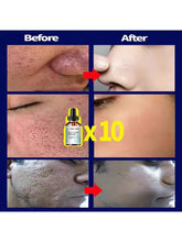 سيروم التحكم في المسام وشد البشرة 5مل/15مل/30مل/50مل/100مل، العناية بالبشرة الاحترافية لتقليل المسام وشد البشرة