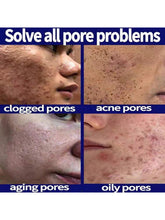 سيروم التحكم في المسام وشد البشرة 5مل/15مل/30مل/50مل/100مل، العناية بالبشرة الاحترافية لتقليل المسام وشد البشرة